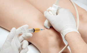 gel injections for knees
